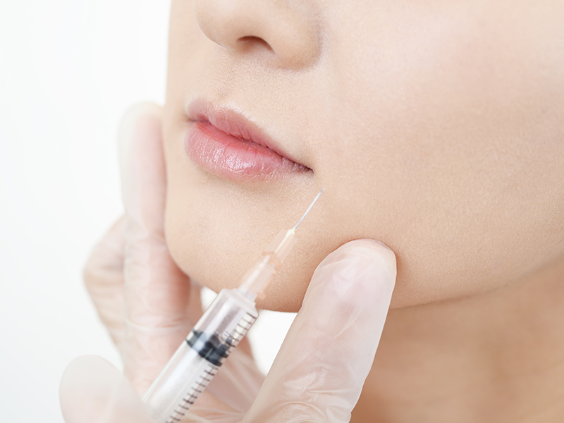 ヒアルロン酸注射