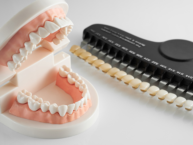 ホワイトニング